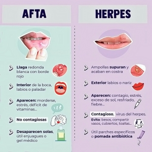 Salah Satu Bentuk Kerjasama Ekonomi ASEAN yang Membuka Kesempatan untuk Perekonomian Regional